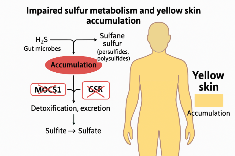 Yellow Skin Without Jaundice: A Sulfur-Redox Link?